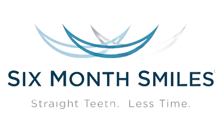 Six Month Smiles Six Month Smiles